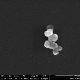 The Tigger Particle (ATD)